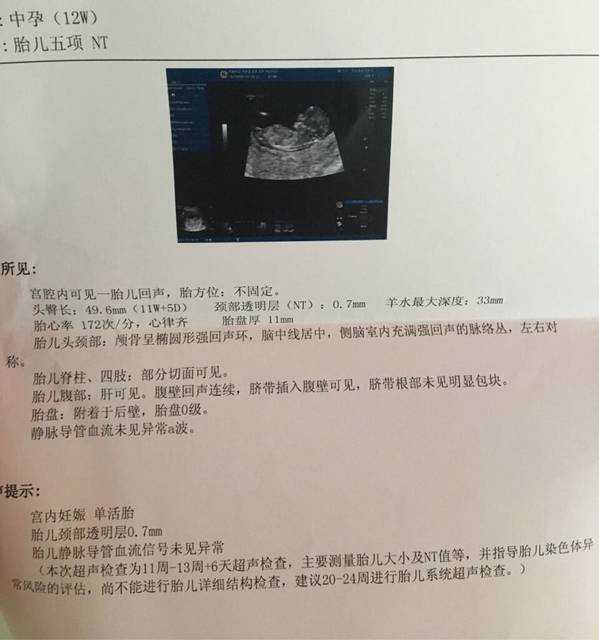 “北京供卵不排队”的真相：一位从医多年的医生给你的心里话