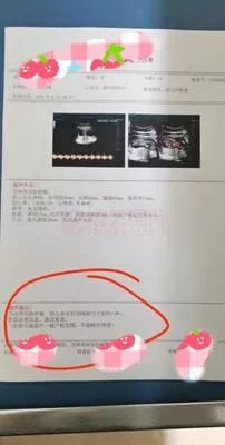 潮汕褚女士24岁子宫内膜异位，三代试管婴儿一次好孕怀上男宝